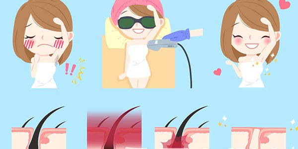 關(guān)于IPL光子脫毛的幾大問題(上)(圖3) 家用光子脫毛儀代工生產(chǎn)