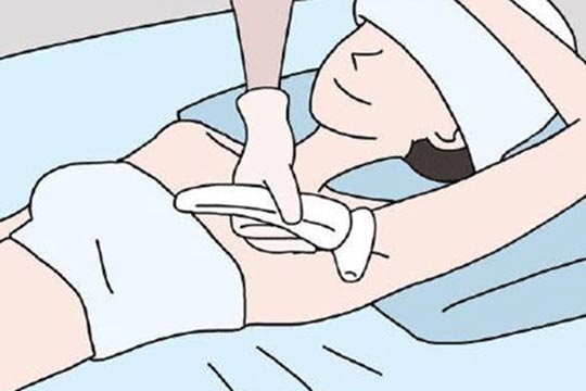 使用家用光子脫毛儀,你需要知道這幾點(圖1) IPL光子脫毛儀