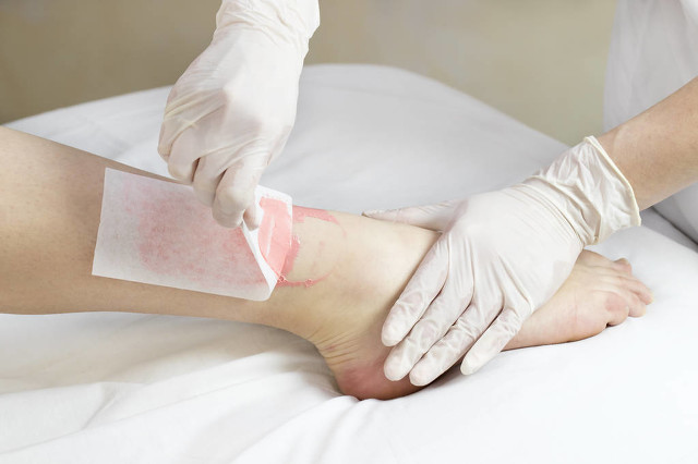 盤點那些年我們用過的脫毛方法——諾鉑創(chuàng)新(圖2) 盤點那些年我們用過的脫毛方法——諾鉑創(chuàng)新(圖2)