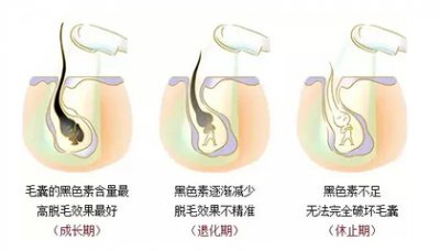 為什么小姐姐們都選擇在春季脫毛呢？