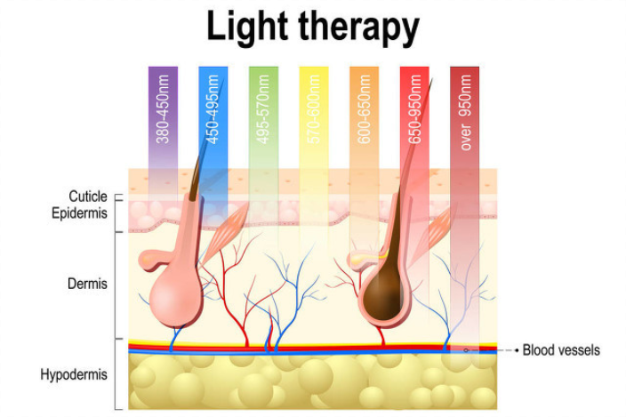 家用光子脫毛儀能夠永久脫毛是騙局還是真相？(圖2)
