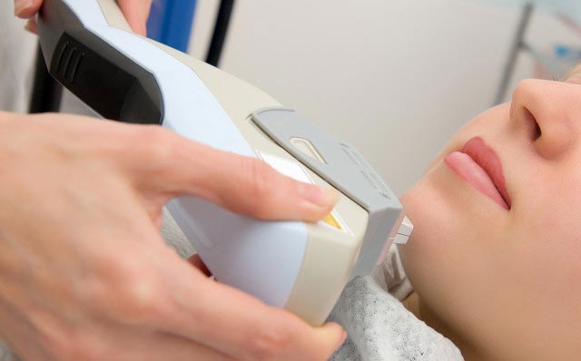 光子脫毛:你必須知道的五件事(圖3) IPL脫毛儀批發(fā)