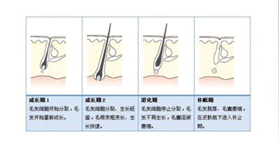 為什么有時候感覺家用脫毛儀效果不明顯？