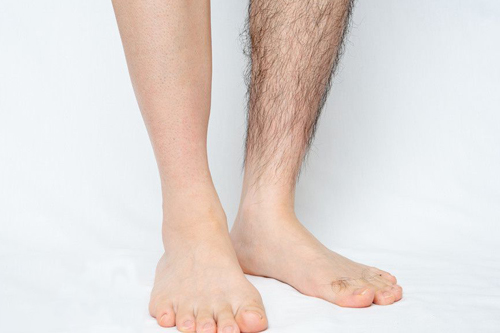 美容院用的脫毛儀哪個牌子好(圖2) 美容院用的脫毛儀哪個牌子好(圖2)