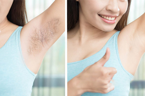 ipl光子脫毛儀怎么使用