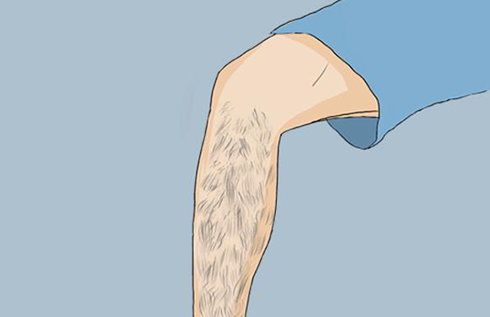 盤點(diǎn)那些錯誤的脫毛方法 ,你中招了沒(圖1) 盤點(diǎn)那些錯誤的脫毛方法 ,你中招了沒(圖1)