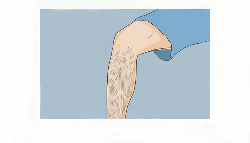 光子脫毛是永久脫毛嗎(圖1) 光子脫毛是永久脫毛嗎(圖1)